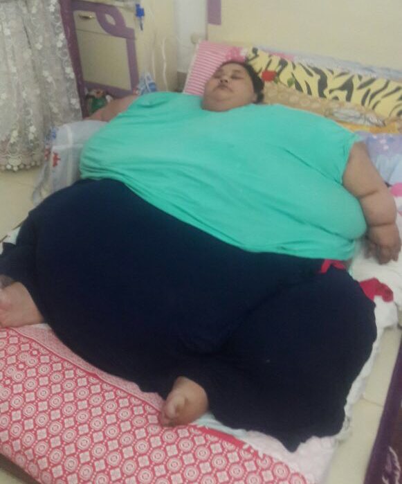 Feature image L'égyptienne Eman, 36 ans, 500 kg