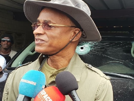 Cellou Dalein Diallo, leader de l'UFDG après l'attaque de son véhicule le 23 octobre dernier à Dixinn