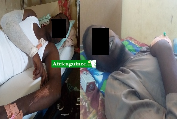 Des blessés alités dans les hôpitaux de Conakry