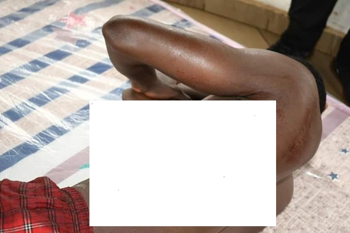 Mamadou Dian Diallo couché sur son lit d'hôpital