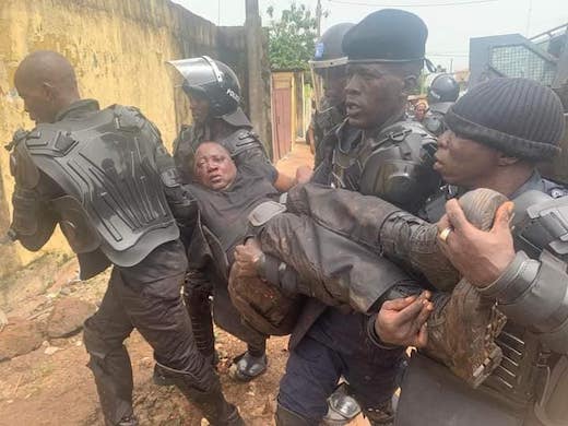 Un policer blessé sur le terrain du maintien d'ordre à Conakry